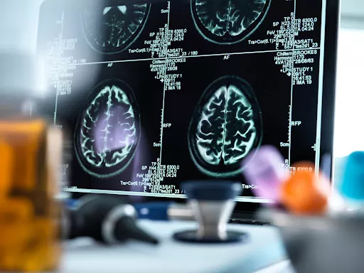 Medical implements on a desk in front of an MRI scan of a brain