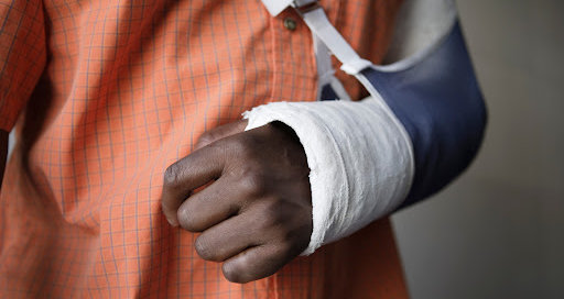 The broken bone injury attorneys on the Get Gordon team can help you get compensation for your broken arm.