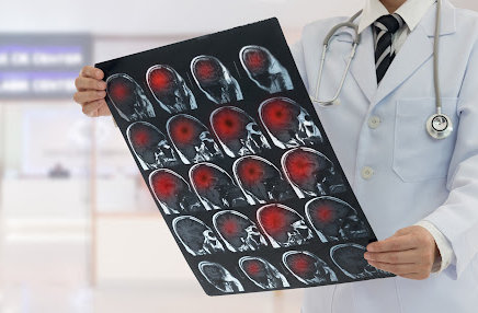 A doctor examines a scan of a patient's brain injuries.