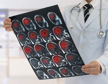 A doctor examining an array of brain scans from a patient with a traumatic brain injury