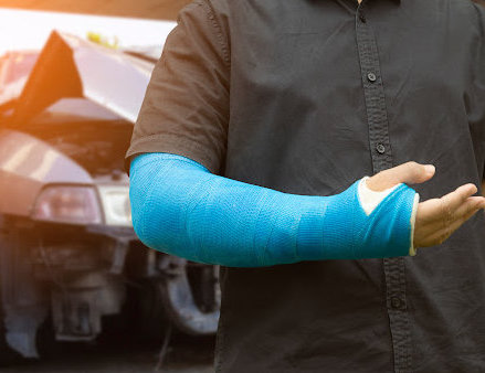 Car Accident injuries like this man's broken arm can keep victims from working.