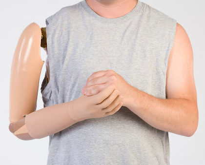 A man with an artificial arm, hands clasped