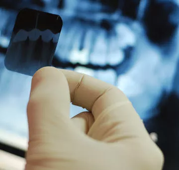 A dentist examining dental x-rays