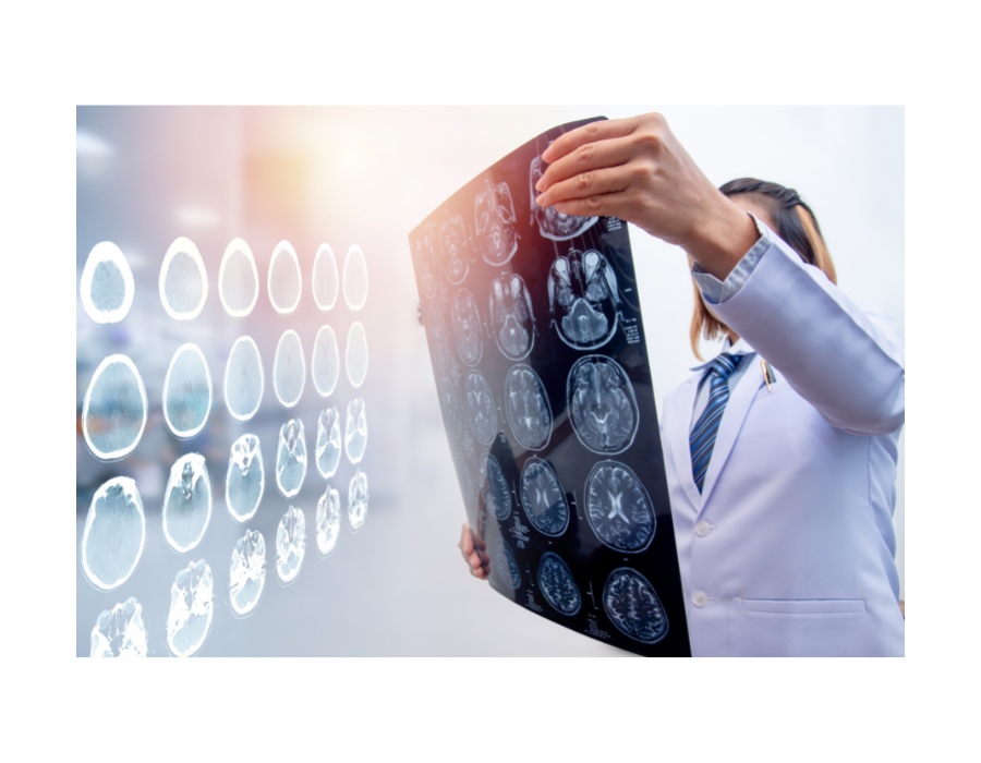 Doctor examining brain scan results from brain injury patient