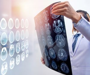 doctor looking at MRI scans of a head - Baton Rouge Catastrophic Injury Lawyer