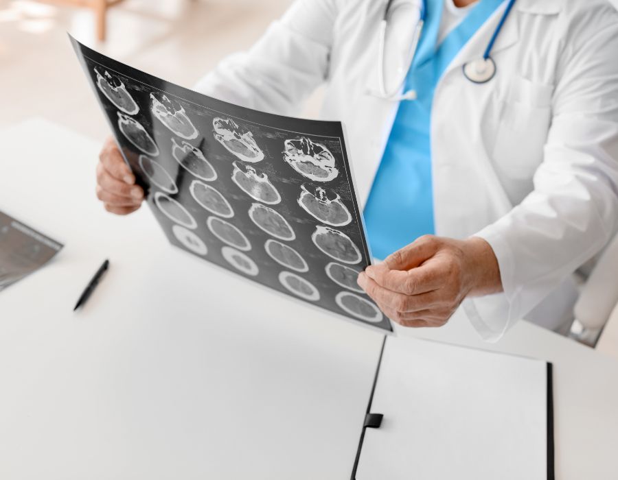 doctor holding scan of brain