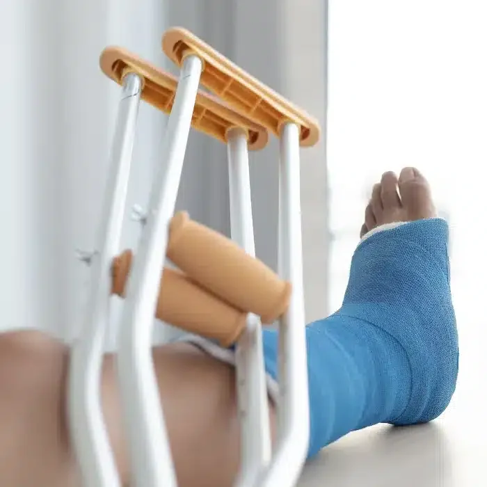 broken foot in a cast