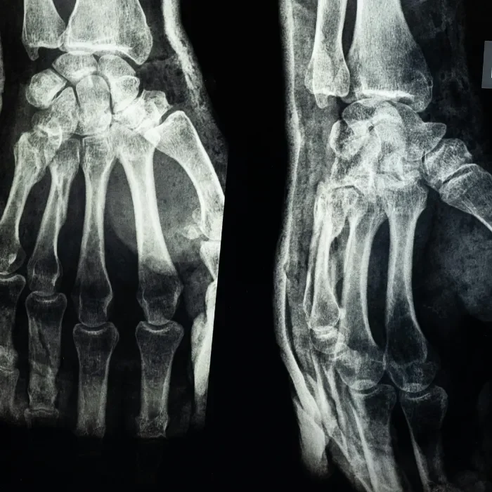 Houma injury law Houma injury law