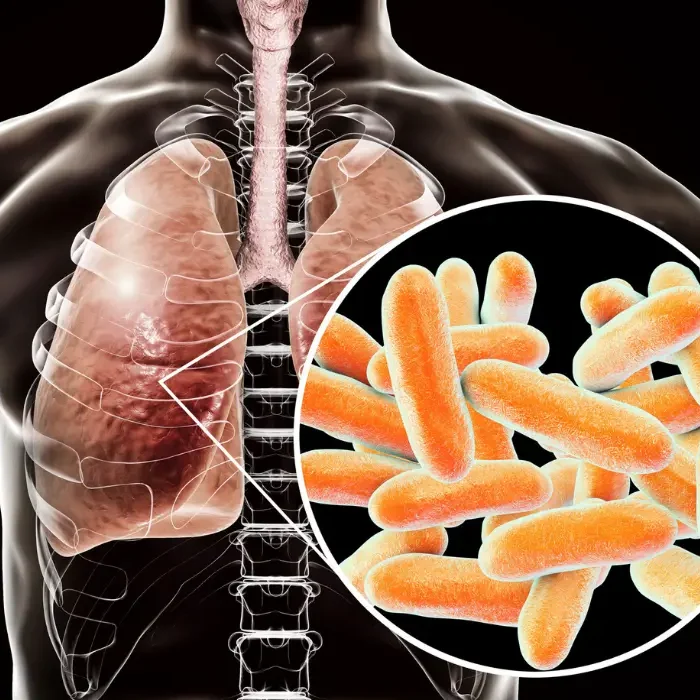 Legionnaires-Disease-Attorney