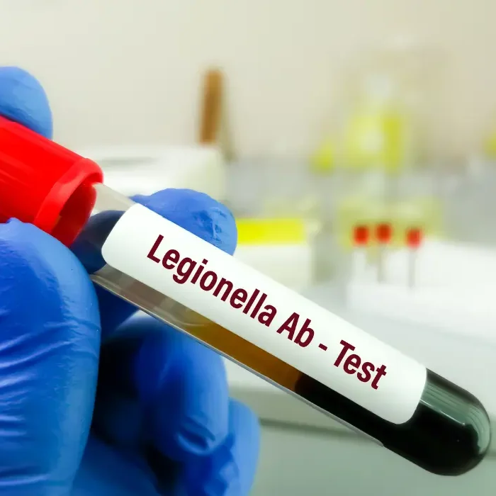 Legionnaires-Disease-Lawyer
