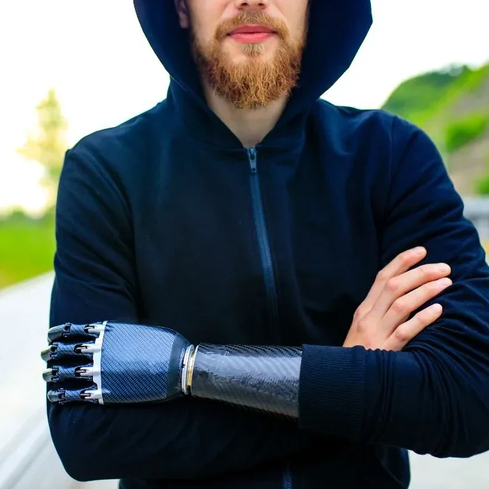 Man with a prosthetic arm