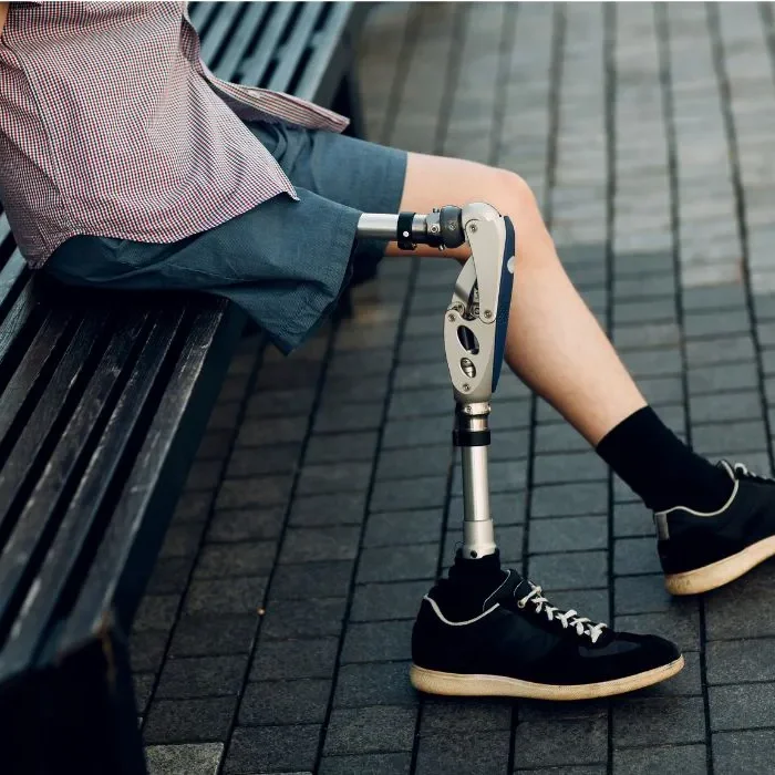 New Orleans Amputation Injury Attorney - man with an amputated leg