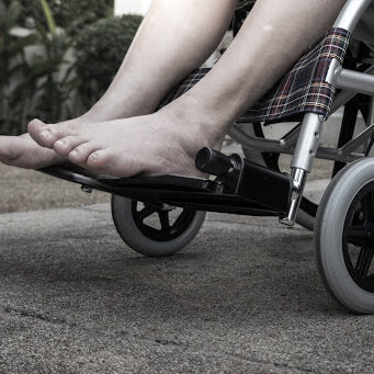 Senior woman paralysis is sitting in a wheelchair