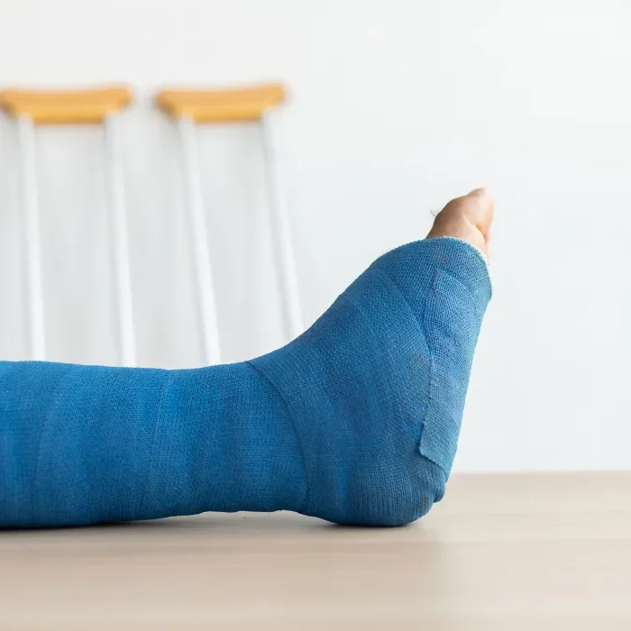 baton-rouge-broken-bones-1