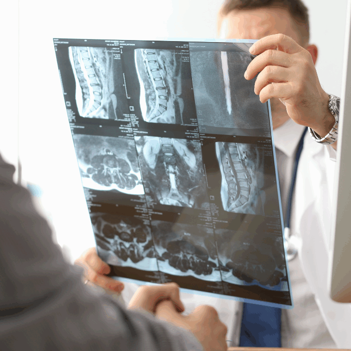 doctor showing patient broken bone xray