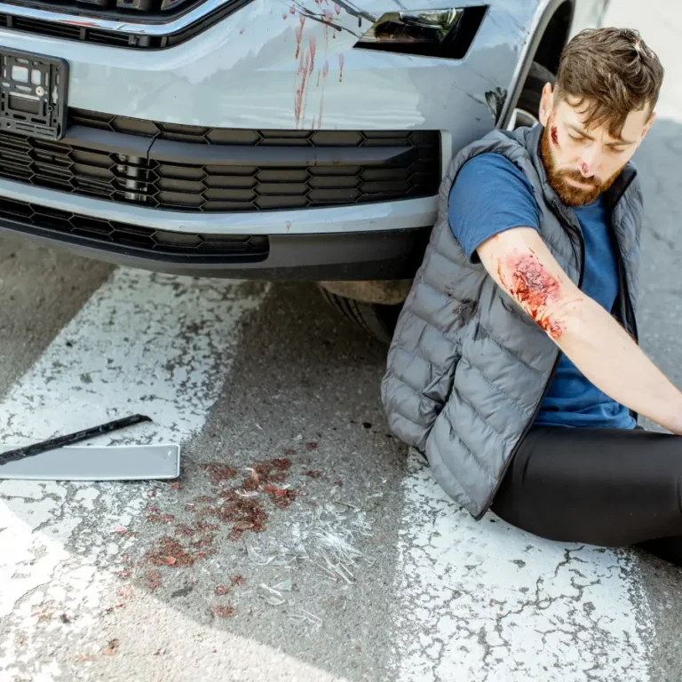 pedestrian accident Baton Rouge 1 (1)