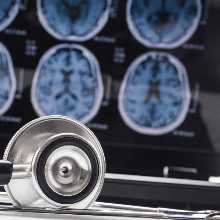 stethoscope in front of brain scan